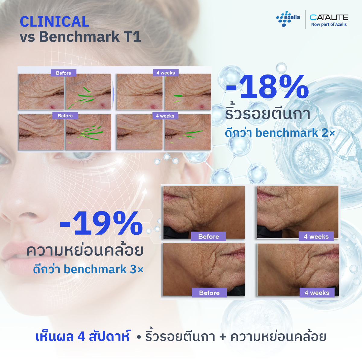 ผลทดสอบ